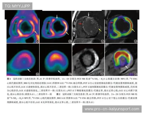 专家提醒：心脏病史者入水前应充分评估并循序适应
